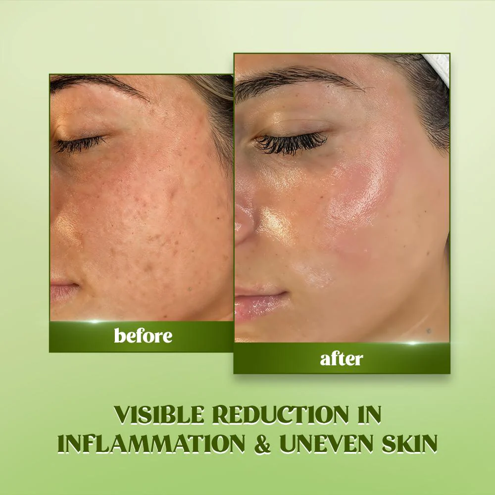 RENEE Matcha Face Serum For Hydration and Glow, 30ml - Image 6