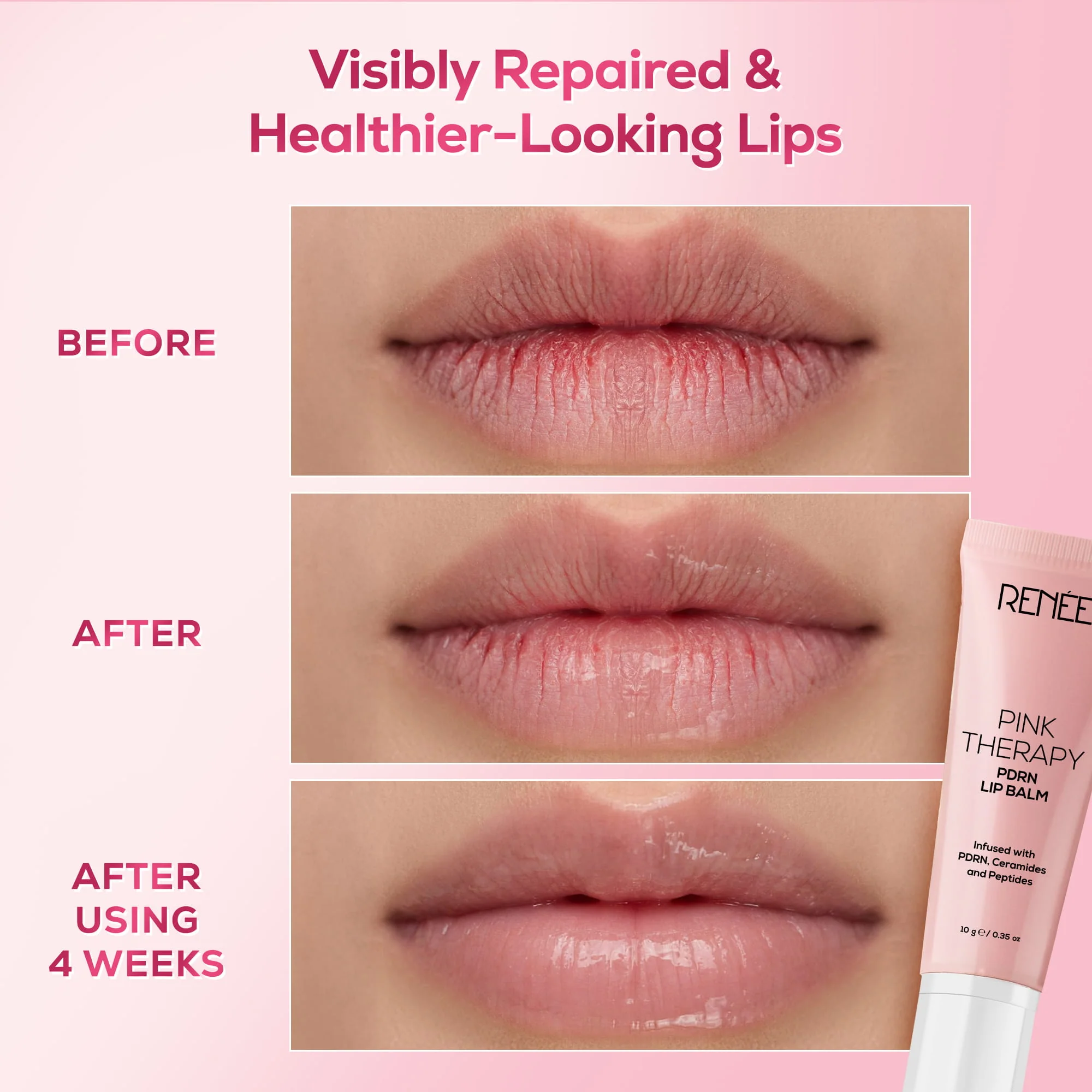 RENEE Pink Therapy Anti-Aging Skincare Combo With Lip Balm - Image 5