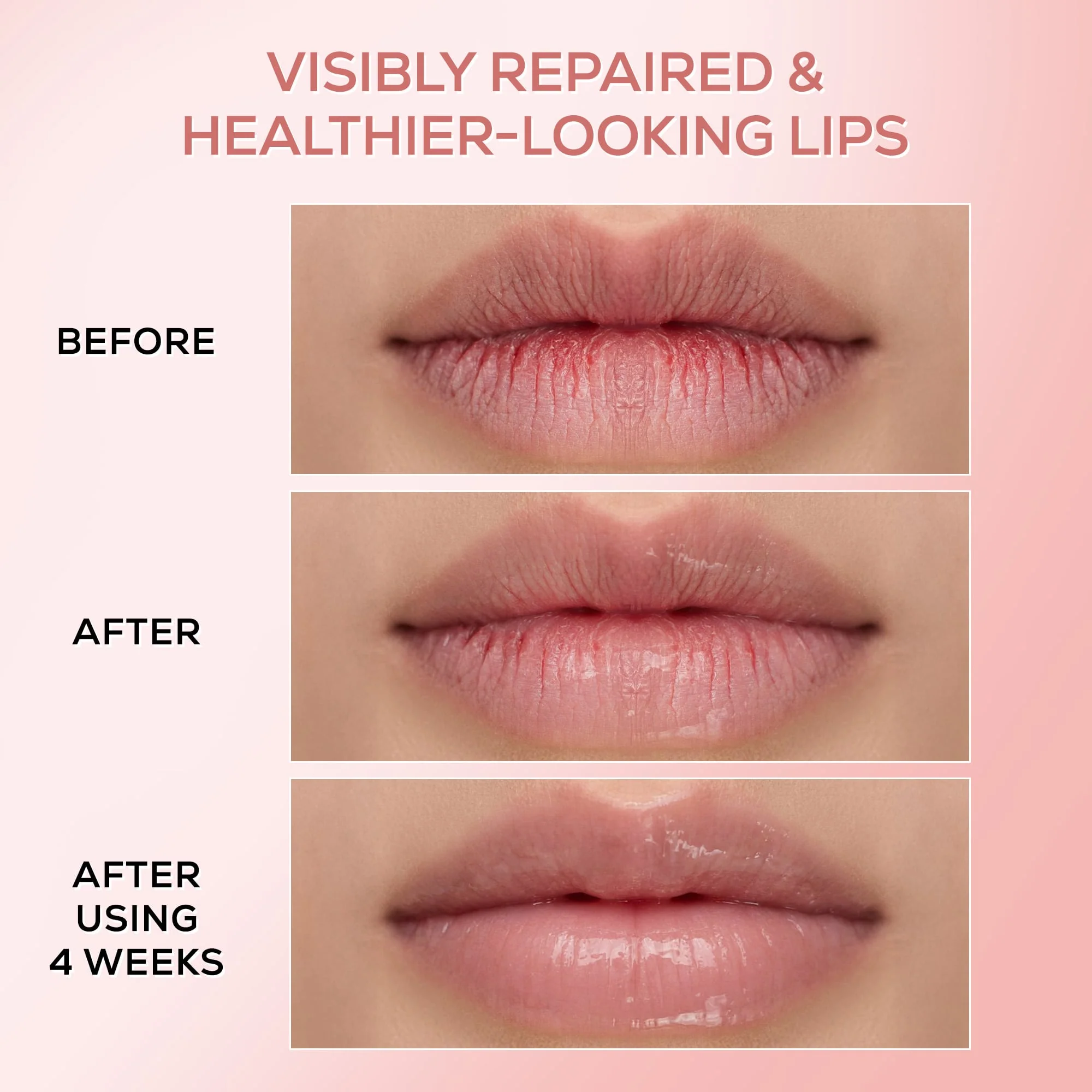 RENEE Pink Therapy PDRN Overnight Lip Repairing & Moisturising Lip Balm For Dry & Chapped Lips, 10g - Image 3